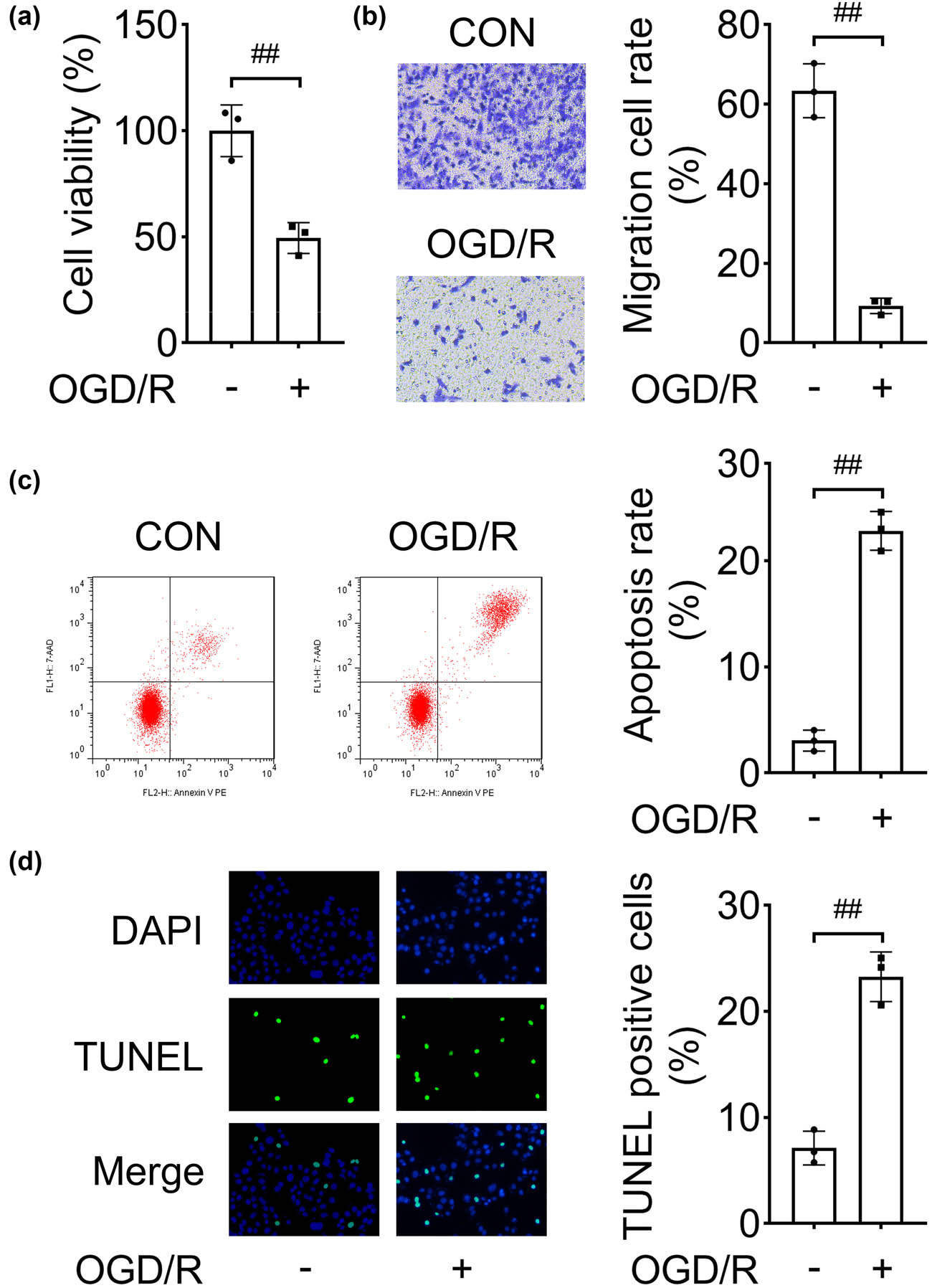 Figure 2
OGD/R inhibits cell migration and induces apoptosis. After the OGD/R NSCs model was established: (a) cell viability was analyzed by CCK-8; (b) cellular migration was assessed using Transwell assay; and apoptosis was evaluated by (c) flow cytometry and (d) TUNEL assay. ##
P < 0.01.