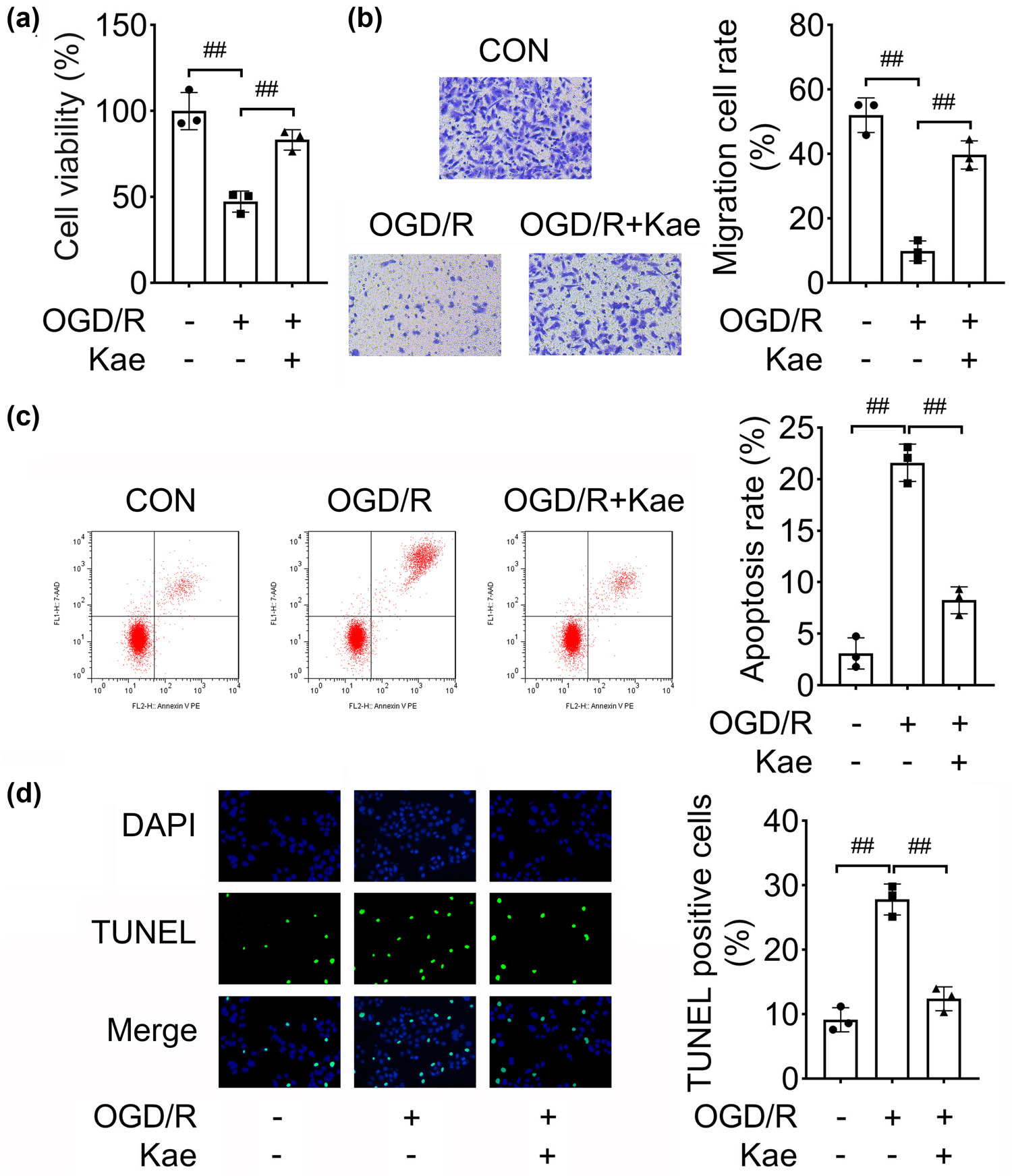 Figure 3
Kae suppresses OGD/R-induced NSC injury. The OGD/R cell model was established and treated with Kae: (a) CCK-8 was carried out to analyze cell viability; (b) transwell assay evaluated cell migration; and apoptosis was assessed using both (c) flow cytometry and (d) TUNEL assay. ##
P < 0.01.