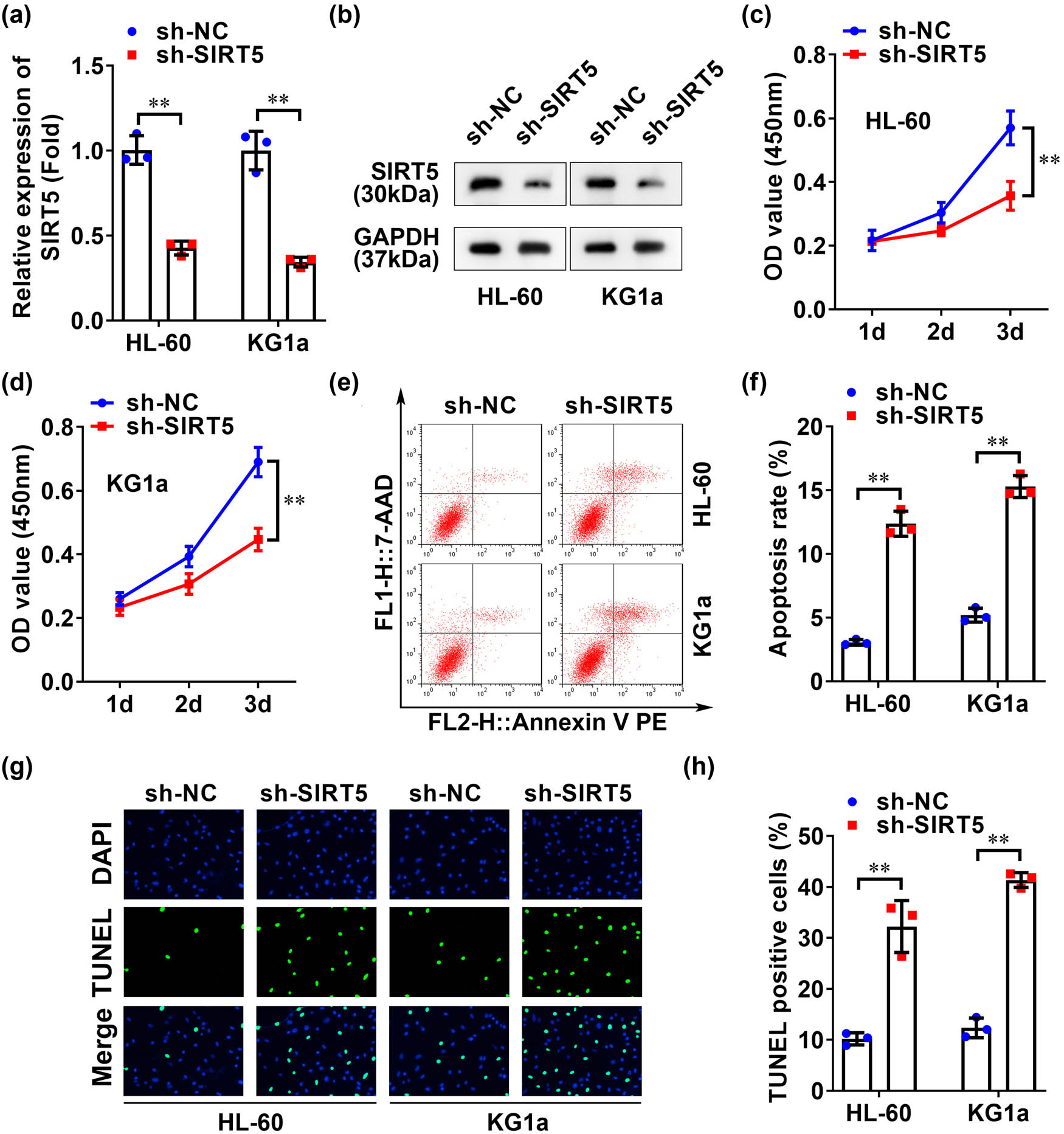 Figure 2
SIRT5 knockdown inhibited the viability and promoted apoptosis of AML cell lines. (a) qRT-PCR and (b) western blotting were used to detect the transfection efficiency of sh-SIRT5 in HL-60 and KG1a cell lines. CCK-8 detected the activity of (c) HL-60 and (d) KG1a cell lines. The apoptosis of HL-60 and KG1a cell lines was detected by flow cytometry (e and f) and TUNEL staining (g and h). **p < 0.01.