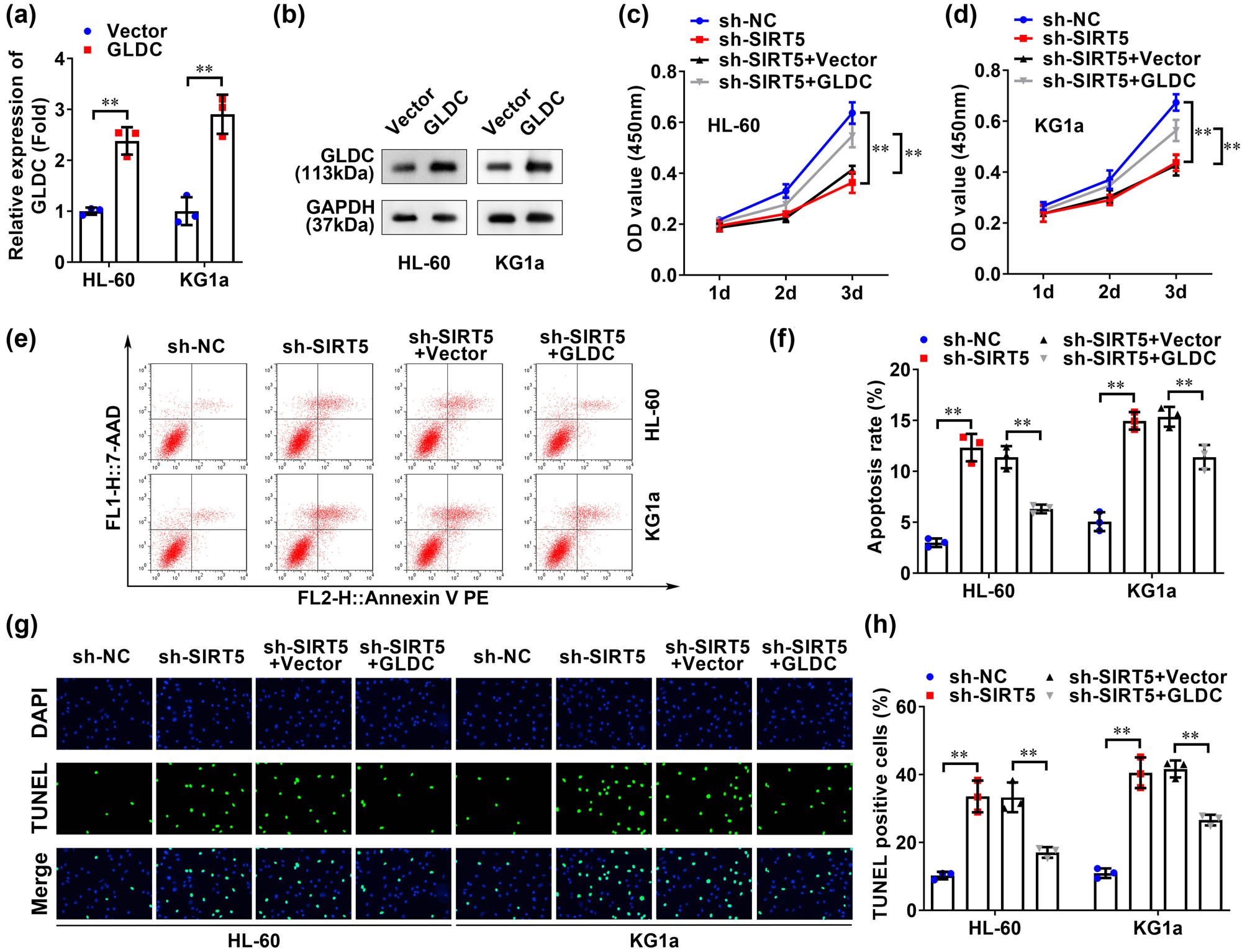 Figure 4
SIRT5 regulated AML cell viability and apoptosis by regulating GLDC. (a) qRT-PCR and (b) western blotting were used to detect the transfection efficiency of GLDC in HL-60 and KG1a cell lines. CCK-8 assays were used to detect the activity of (c) HL-60 and (d) KG1a cell lines. The apoptosis of HL-60 and KG1a cell lines was detected by flow cytometry (e and f) and TUNEL staining (g and h). **p < 0.01.