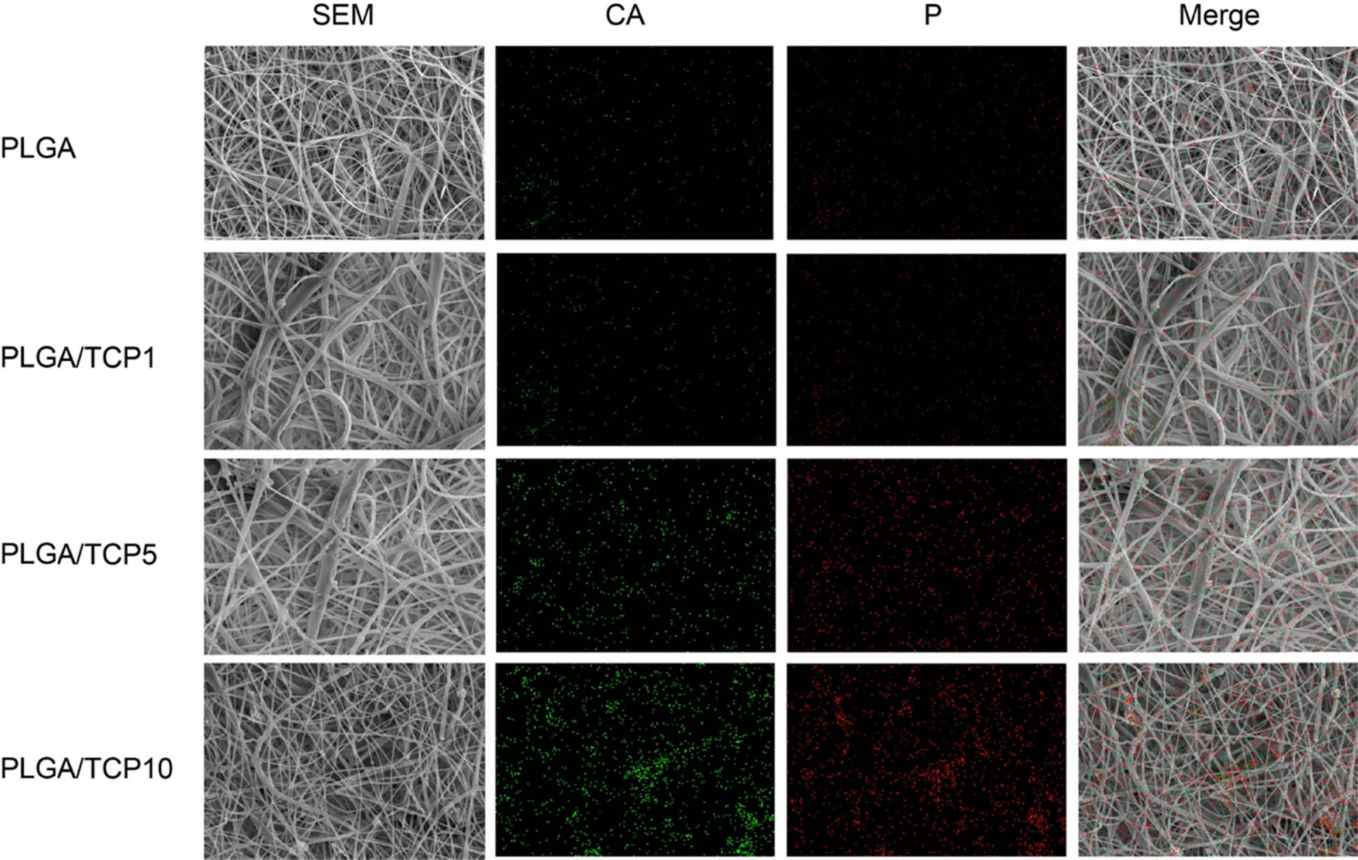 Figure 3
Microscopic morphology and elemental distribution of the membranes. First column: SEM of the membrane; second column: elemental distribution of calcium; third column: elemental distribution of phosphorus; fourth column: elemental distribution on the membrane.