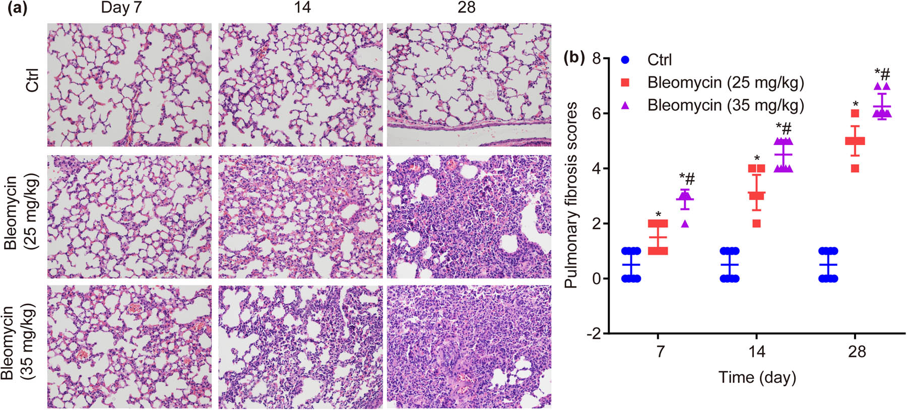 Figure 3
Hematoxylin–eosin (HE) staining in lung tissues of mice in each group. BLM dose- and time-dependently increases HE staining in the lower lobe of the right lung (×200) (a) and PF scores (b). *P < 0.05, vs ctrl, #
P < 0.05 vs BLM low group.