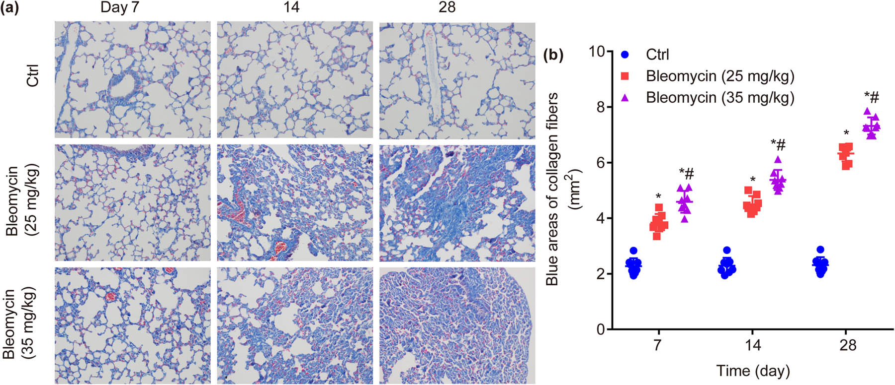 Figure 4
Masson staining in lung tissues of mice in each group. BLM dose- and time-dependently increases Masson staining in the lower lobe of the right lung (×200) (a) and the blue areas of collagen fibers (b). *P < 0.05 vs ctrl, #
P < 0.05 vs BLM low group.