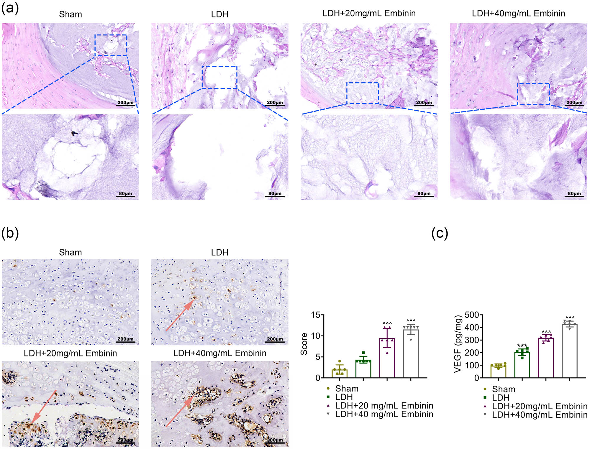 Figure 1 
                  Embinin promotes lumbar disc neovascularization in LDH rats. (a) H&E staining showed the nucleus pulposus tissues of rats upon the indicated treatment. Significant morphological changes and degeneration of the nucleus pulposus were observed in the LDH group, and the amount of NP within the disc was dramatically decreased after surgery. Scale bar, 200 μm. (b) IHC assays showed the expression of CD34 in the nucleus pulposus tissues of rats upon the indicated treatment. The percentage of CD34-positive cells were calculated. Scale bar, 200 μm. The arrows indicate the positive signal. (c) ELISA assays showed the secretion of VEGF in the nucleus pulposus tissues of rats upon the indicated treatment. Error bars indicate SD. ***p < 0.001, LDH vs sham, ^^p < 0.01, ^^^p < 0.001, LDH + Embinin vs LDH.
               
