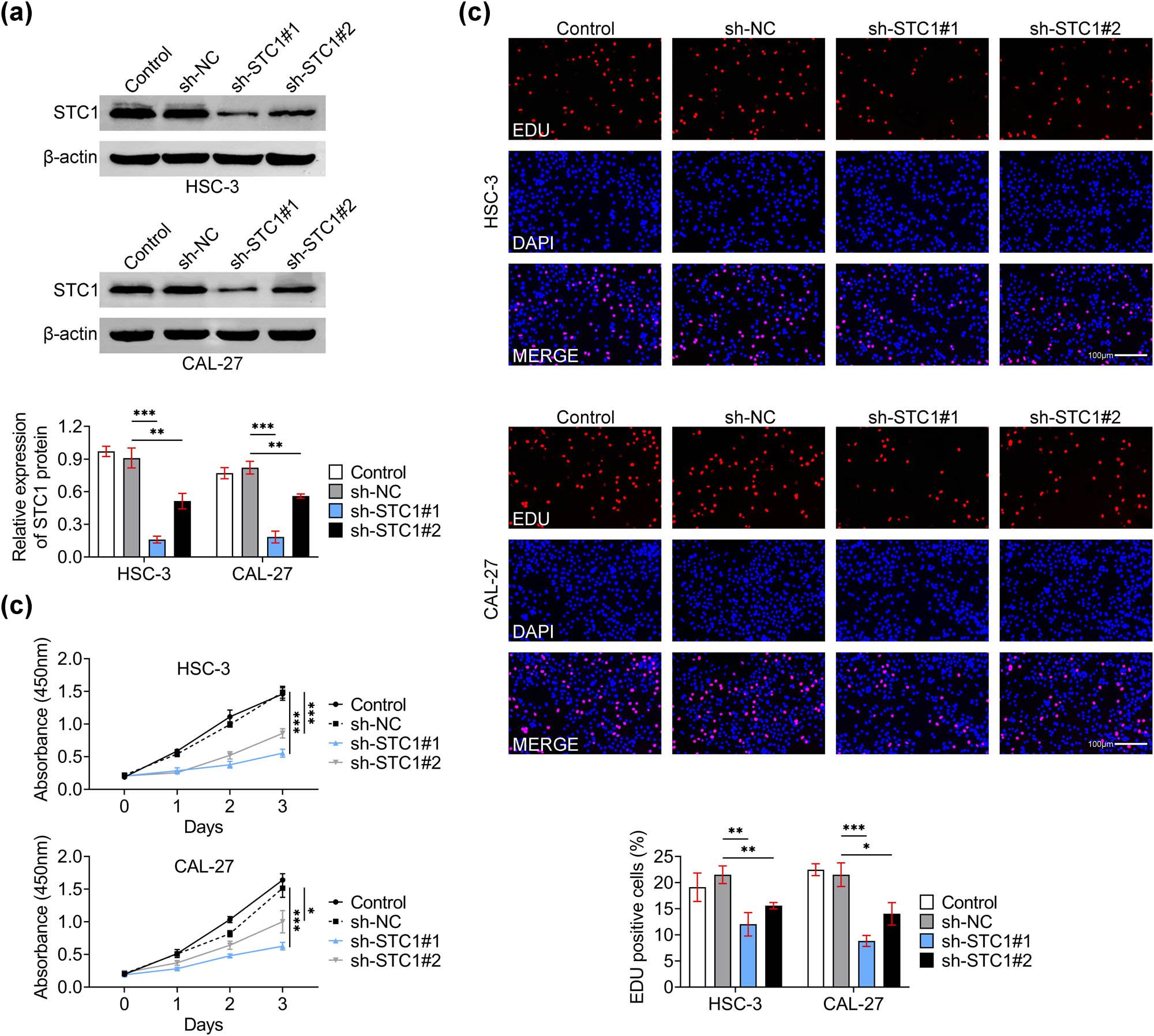 Figure 2
The depletion of STC-1 suppressed the growth of OSCC cells. (a) Immunoblot assays showed the expression of STC-1 in HSC3 (up) and CAL27 (down) cells upon the transfection of sh-NC, sh-STC-1#1, and sh-STC-1#2 for 24 h. The relative STC-1 expression was quantified. (b) CCK-8 assays showed the growth of HSC-3, and CAL-27 cells upon the transfection of sh-NC, sh-STC-1#1, and sh-STC-1#2 for 24, 48, and 72 h. OD450 value was measured. (c) Edu assays showed the growth degree of HSC-3, and CAL-27 cells upon the transfection of sh-NC, sh-STC-1#1, and sh-STC-1#2 for 24 h. The percentage of Edu-positive cells was quantified. Scale bar, 100 μm. Red panel indicates Edu. *p < 0.05, **p < 0.01, ***p < 0.001, sh-STC-1 vs sh-NC. NC, negative control.