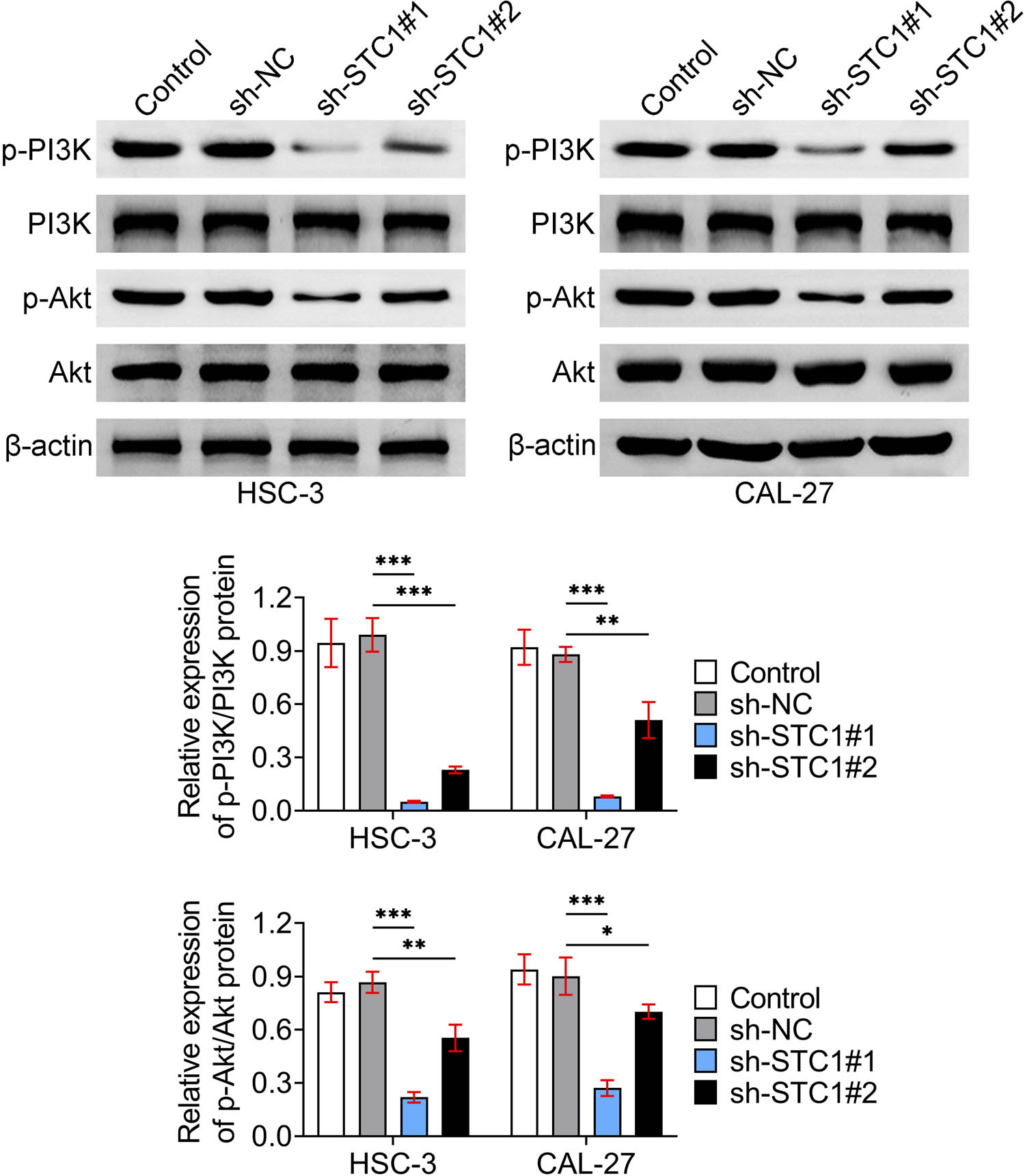 Figure 4
STC-1 knockdown suppressed the PI3K/Akt pathway in OSCC cells. Immunoblot showed the expression and phosphorylation levels of PI3K and Akt in HSC-3, and CAL-27 cells upon the transfection of sh-NC, sh-STC-1#1, and sh-STC-1#2 for 24 h was measured by the kit. The relative phosphorylation levels were quantified. *p < 0.05, **p < 0.01, ***p < 0.001, sh-STC-1 vs sh-NC. NC, negative control.