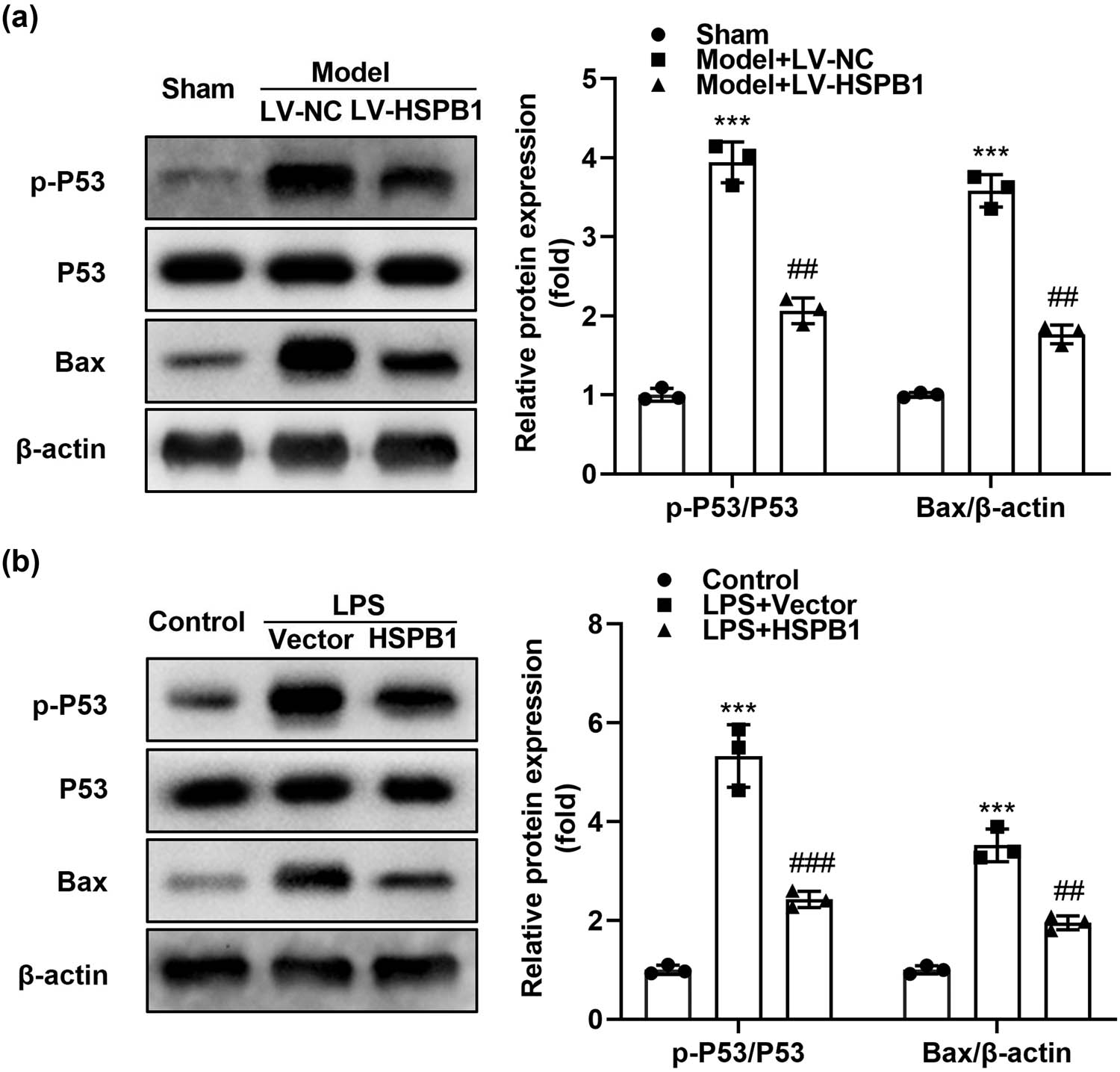 Figure 3
HSPB1 suppresses the activation of the P53/Bax pathway. (a) p-P53, P53, and Bax protein levels were detected and quantified in the liver tissues of mice. (b) p-P53, P53, and Bax protein levels were detected in L02 cells and quantified. ***P < 0.001. ###
P < 0.001. ##
P < 0.01.