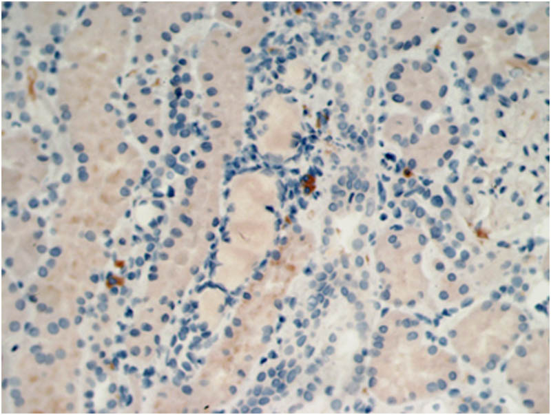 Figure 2
Immunohistochemical analysis of IgG4+ plasma cells < 10/high power field (Hp) (400×).