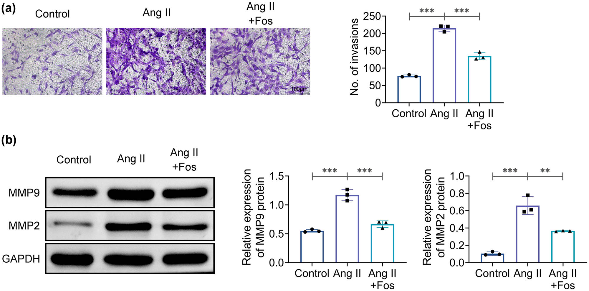 Figure 3
Fosinopril inhibits Ang II-induced VSMC migration. (a) Representative images of the Transwell assay and quantification of migrating cells. (b) Western blot analysis of MMP2 and MMP9 protein levels. Data are presented as mean ± SD. **p < 0.01 and ***p < 0.001 compared to the control/Ang II group. n = 3.