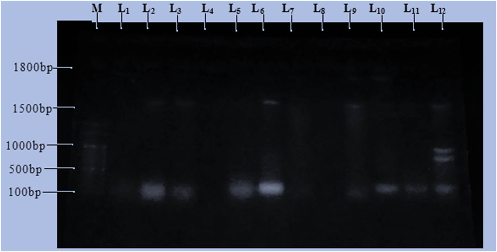 Figure 3
Plasmid size determination and a band size of 12 multi-drug-resistant bacteria. Key: M-Marker, L1-SD1, L2-SK5, L3-SD15, L4-SK8, L5-SK7, L6-SK3, L7-SD4, L8-SD7, L9-SD11, L10-SD2, L11-SK2, L12-SD16.