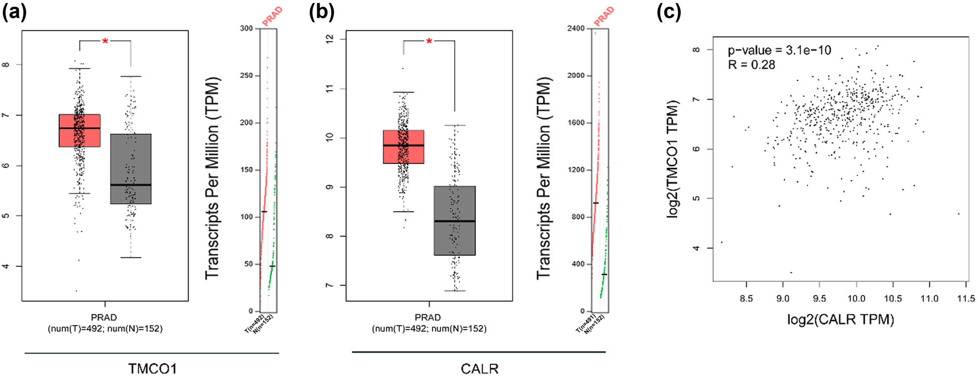 Figure 1
TCGA data analysis TMCO1 and CALR. (a) TCGA data analysis of TMCO1 expression specificity. In the box figure, the red is the expression of TMCO1 in cancer tissue, and the black is the expression of TMCO1 in normal prostate tissue. (b) TCGA data analysis of CALR expression specificity. In the box figure, red is the expression of CALR in cancer tissue, and black is the expression of CALR in normal prostate tissue. (c) Correlation between TMCO1 and CALR expression was analyzed by TCGA data. PRAD is PCa. *P < 0.05.