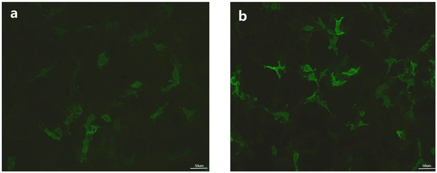 Figure 3
Immunofluorescent microscopy reactivity of CSF and blood. GABABR antibodies in blood (a) and CSF (b) were validated by a cell-based indirect immunofluorescence test (1:3.2).