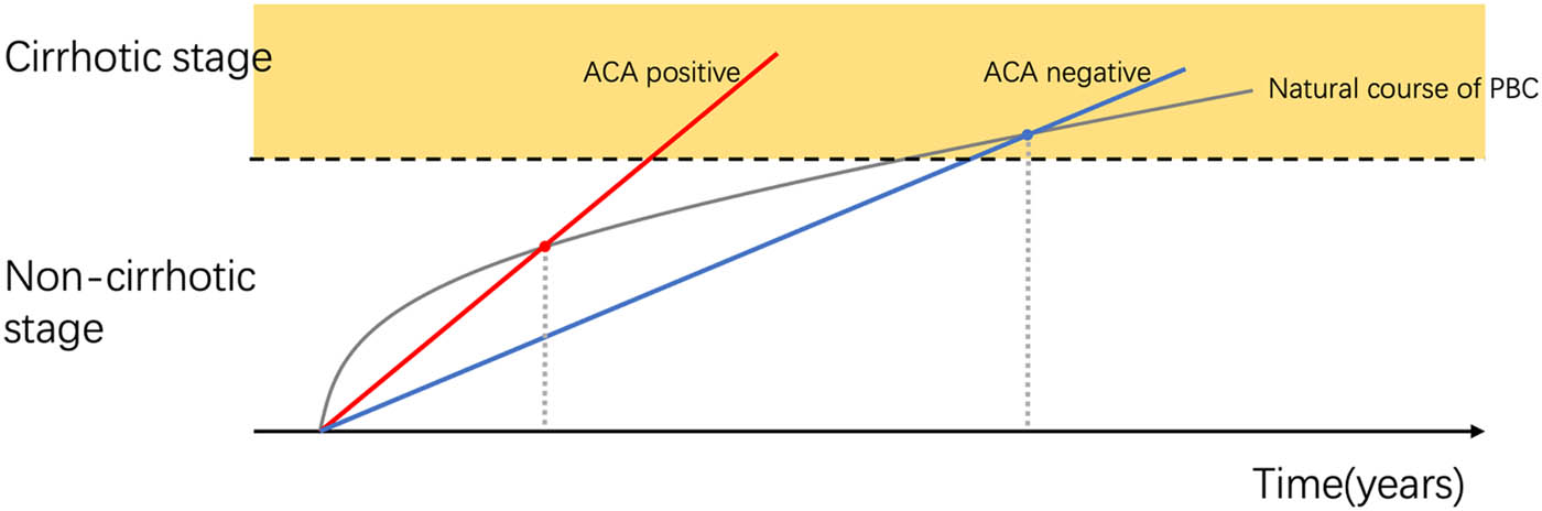 Figure 4
Assumed gastroesophageal varices progression pattern of PBC patients with positive and negative ACA. Gray curve: assumed natural course of PBC. Straight red line: assumed varix progression in ACA-positive PBC patients. Blue line: assumed varix progression of ACA-negative PBC patients. The dot where the red line and the curve intersect occurs earlier than the point where the blue line and the curve intersect.