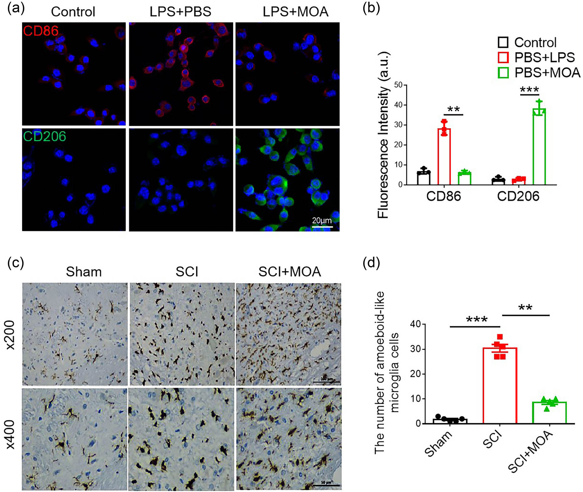 Figure 3
(a) Immunofluorescence-stained macrophages in the control, LPS + PBS, and LPS + MOA groups. M1 macrophage (CD86: red), M2 macrophage (CD206: green). (b) Fluorescence intensity of the control, LPS + PBS, and LPS + MOA groups, **, ***p < 0.05. (c) Immunohistochemical staining of Iba1 in Sham, SCI, and MOA groups 3 day following contusion. (d) The number of amoeboid-like microglia 3 day following contusion. **, ***p < 0.01, n = 5. Scale bar = 100 µm, scale bar = 50 µm.