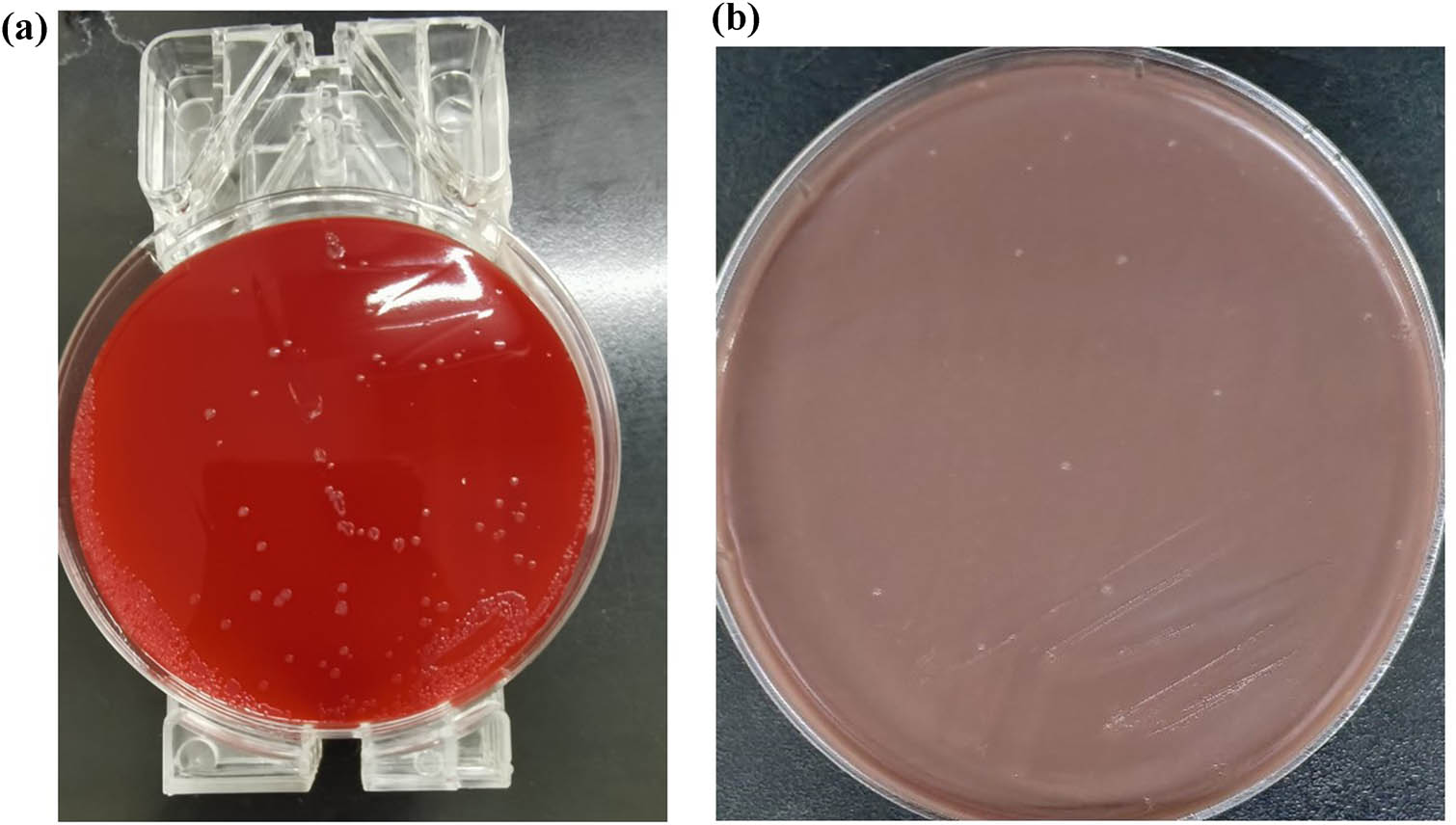 Figure 3 
               Culture results of blood agar plate (a) and chocolate agar (b).