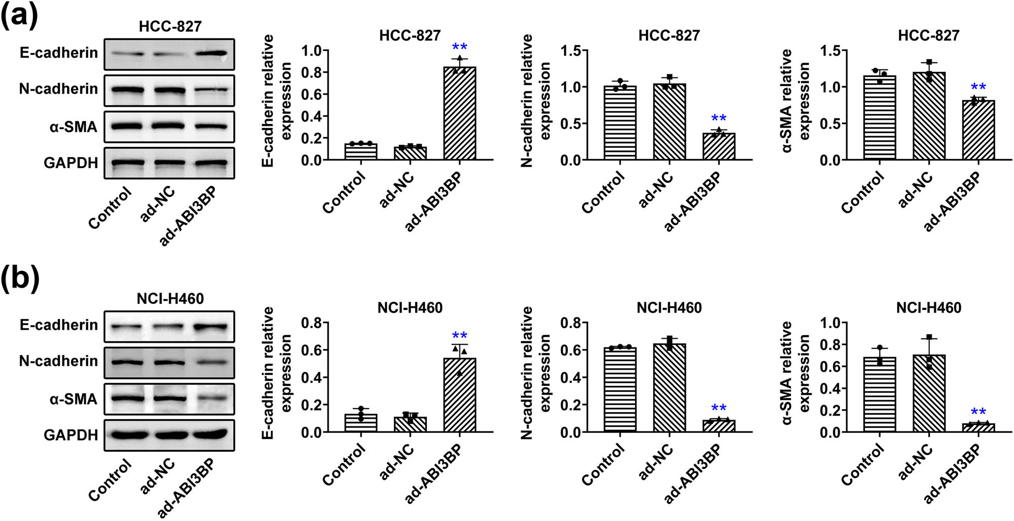 Figure 3 
                  ABI3BP overexpression suppressed the EMT process of NSCLC cells. (a) and (b) Immunoblot showing E-cadherin, N-cadherin, and α-SMA protein levels in HCC-827 (a) and NCI-H460 (b) cells upon the indicated infection. GAPDH was used as the loading control. Quantification of relative E-cadherin, N-cadherin, and α-SMA expression is shown on the right. Data are represented as mean ± SD. **p < 0.01, ad-ABI3BP vs ad-NC. NSCLC, non-small-cell lung cancer. NC, negative control.