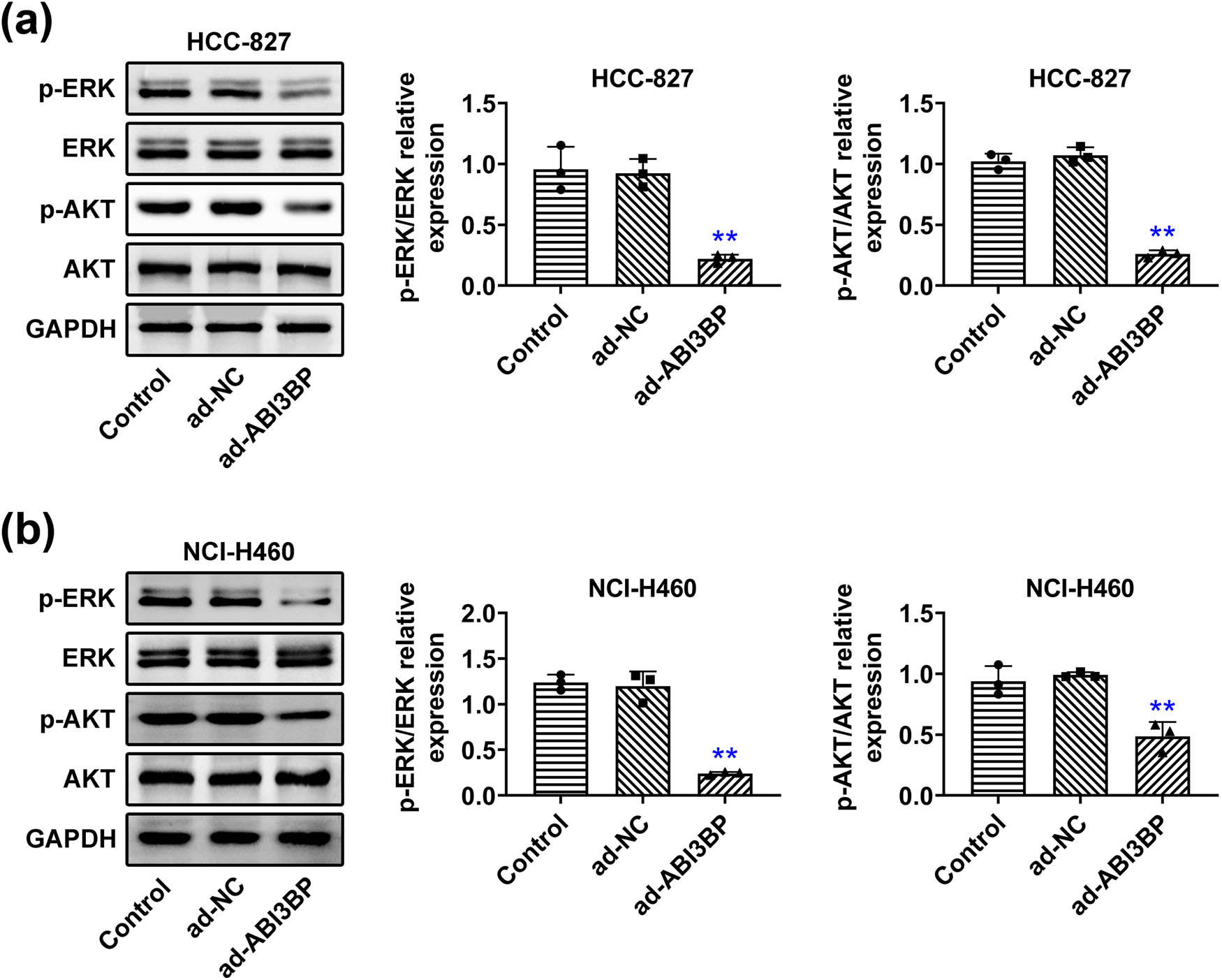 Figure 4 
                  ABI3BP overexpression suppressed the MAPK/ERK pathway in NSCLC cells. (a) and (b) Immunoblot showing ERK and AKT protein levels and phosphorylation levels in HCC-827 (a) and NCI-H460 (b) cells upon the indicated infection. GAPDH was used as the loading control. Quantification of relative phosphorylation levels of ERK and AKT is shown on the right. Data are represented as mean ± SD. **p < 0.01, ad-ABI3BP vs ad-NC. NSCLC, non-small-cell lung cancer. NC, negative control.