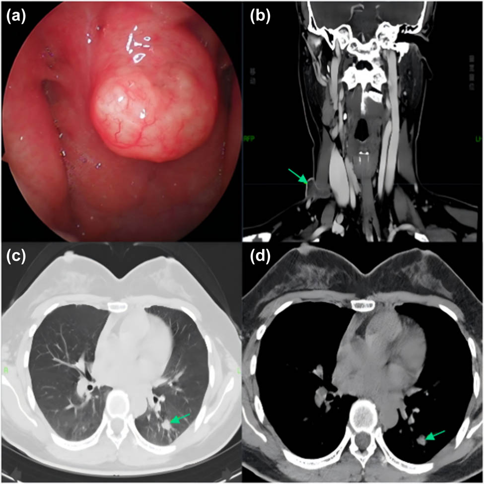 Teaser image from the article
