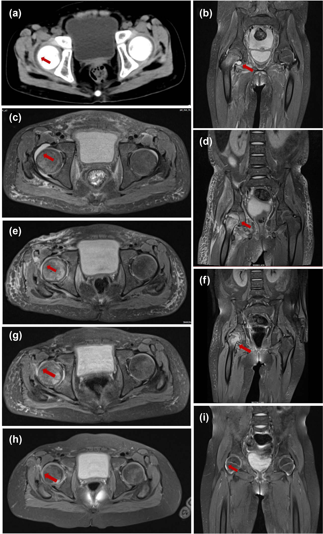 Teaser image from the article