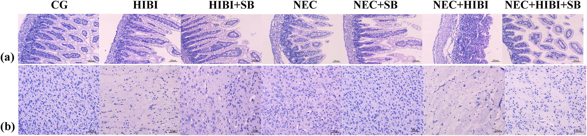 Figure 1 
                  SB ameliorated pathological intestinal and brain injury in neonatal rats. (a) HE staining of intestinal tissue. (b) HE staining of brain tissue.