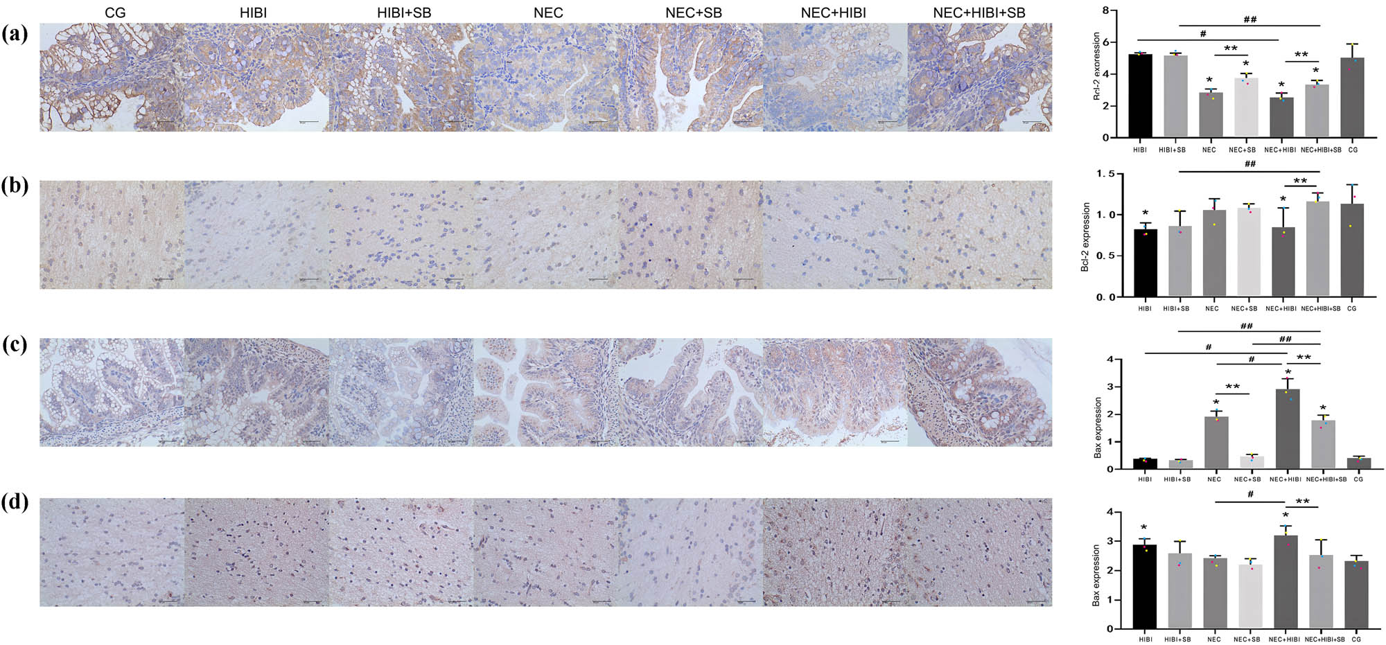 Figure 3 
                  SB regulated the protein expression of Bcl-2 and Bax in intestinal and brain tissues. Immunohistochemistry result of Bcl-2 protein expression in intestinal (a) and brain (b) tissues. Immunohistochemistry result of Bax protein expression in intestinal (c) and brain (d) tissues. *P < 0.05, **P < 0.01; #
                     P < 0.05, ##
                     P < 0.01.