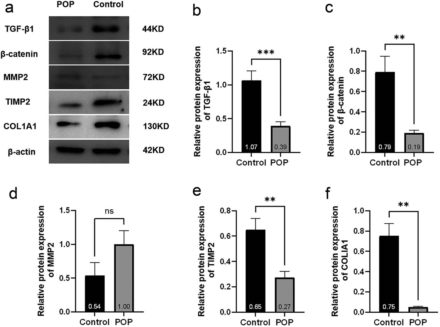Figure 6
(a) Strip graph of the western blot and (b)–(f) statistical analysis results of western blot.
