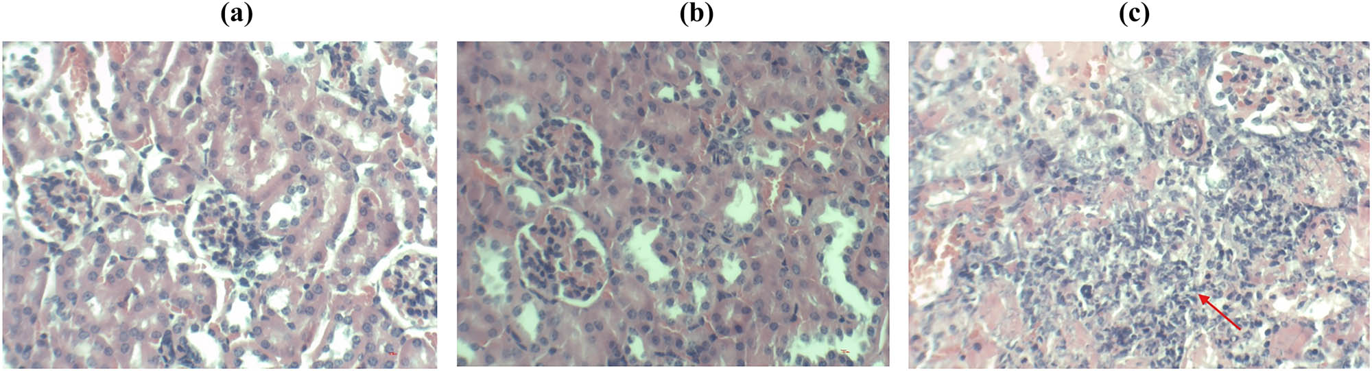 Figure 10
HE staining of kidney tissue (a) saline, (b) Ire1Δ/Δ, and (c) SN152 groups.