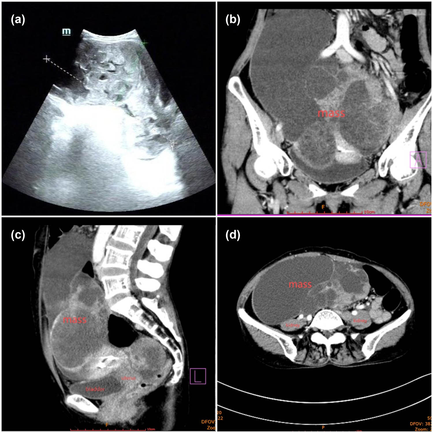 Teaser image from the article