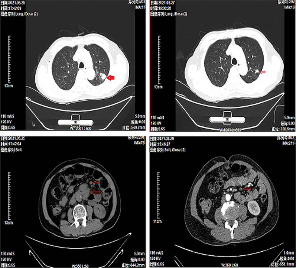 Teaser image from the article