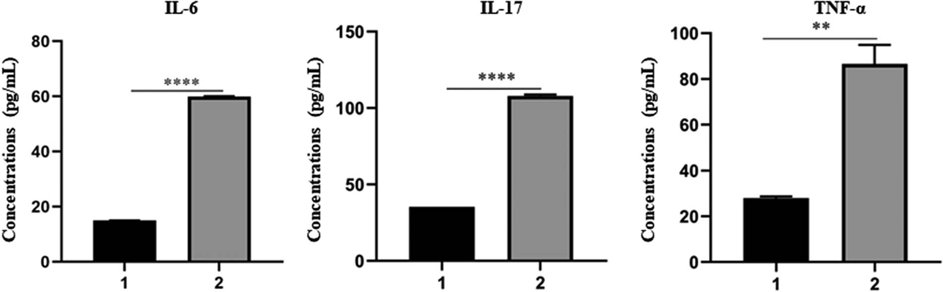 Figure 3
Protein expression levels of IL-6, IL-17, and TNF-α in tear of rats between the treatment group and the normal control group.