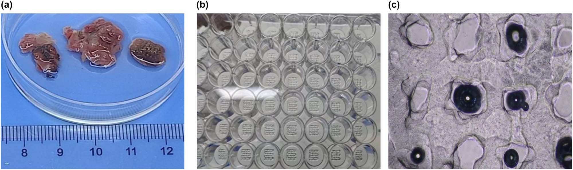 Figure 3
Fabrication of 3DP tumor models. Photographs of freshly resected tumor specimens (a), GIST 3DP models in 48-well plate (b), and bright field image of 3DP tumor models (c).
