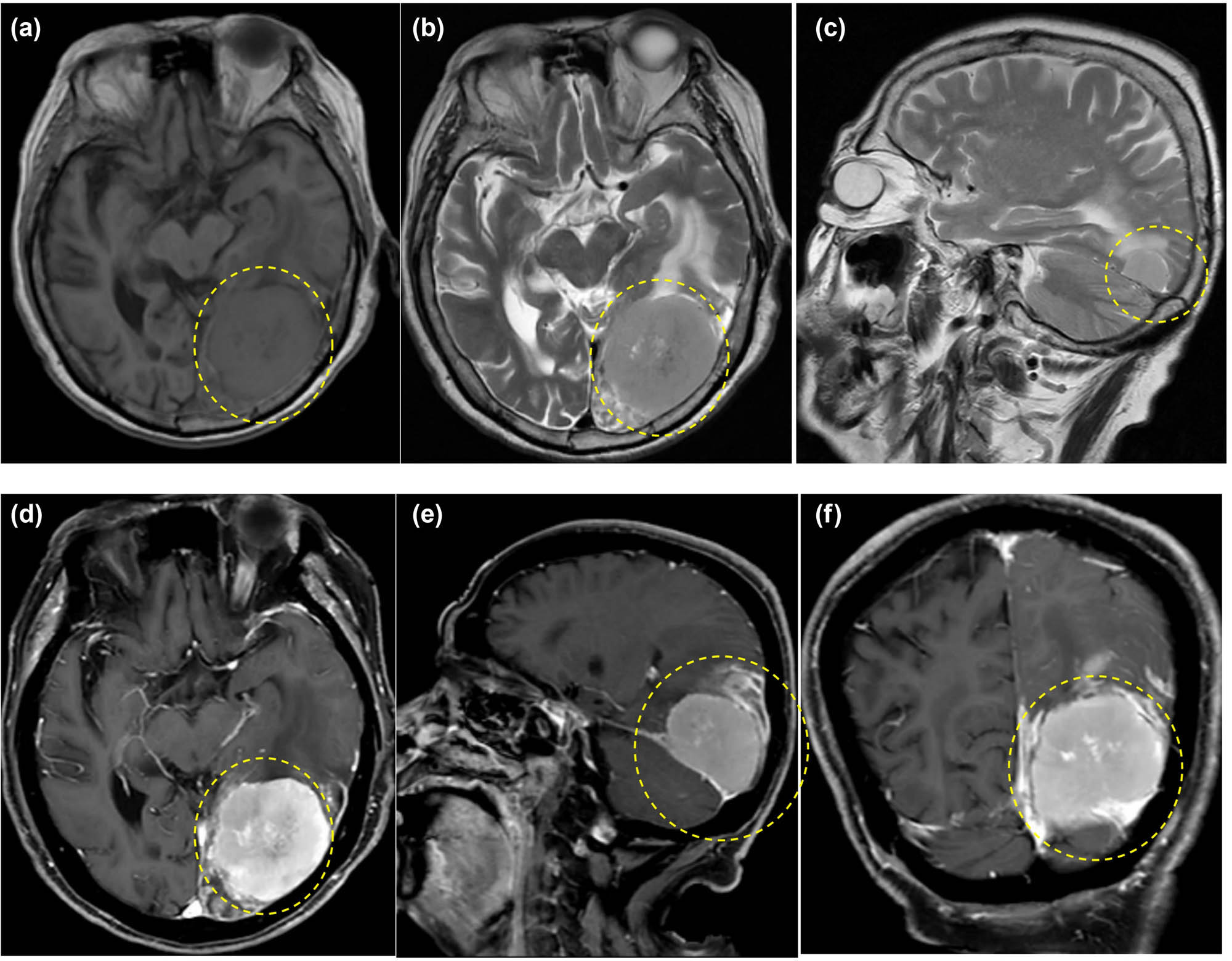 Teaser image from the article