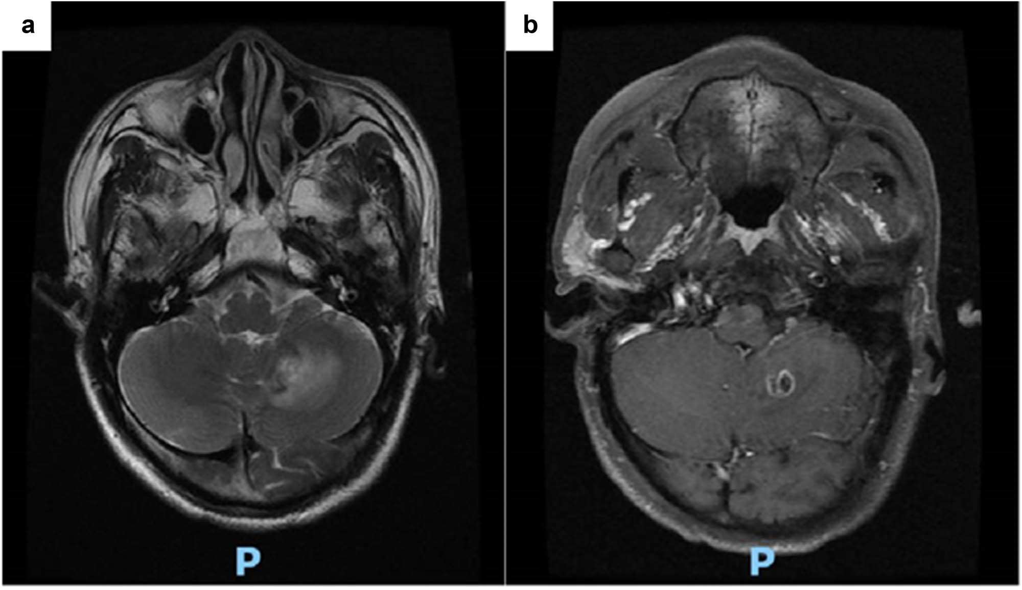 Teaser image from the article