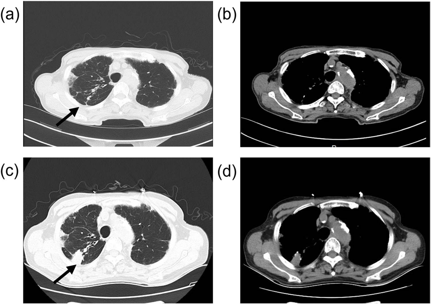 Teaser image from the article