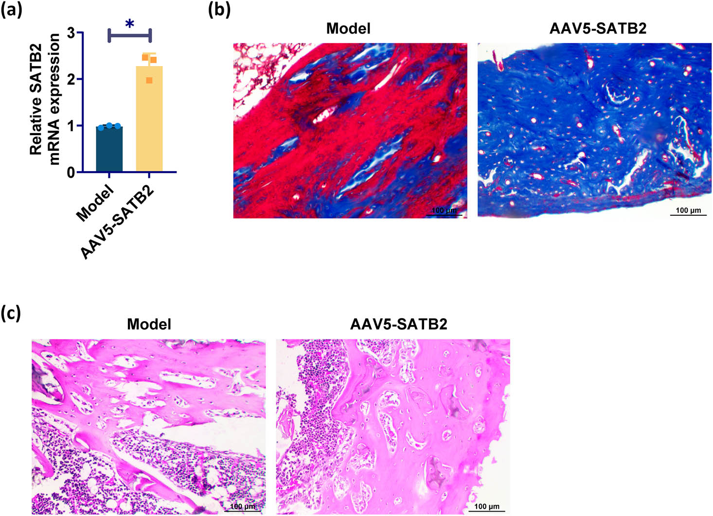 Figure 2 
                  SATB2 promotes humeral fracture healing: (a) RT-qPCR was used to detect SATB2 expression, (b) MS staining shows the degree of fracture healing, and (c) HE staining shows histological findings of bone healing. *p < 0.05 was considered statistically significant.