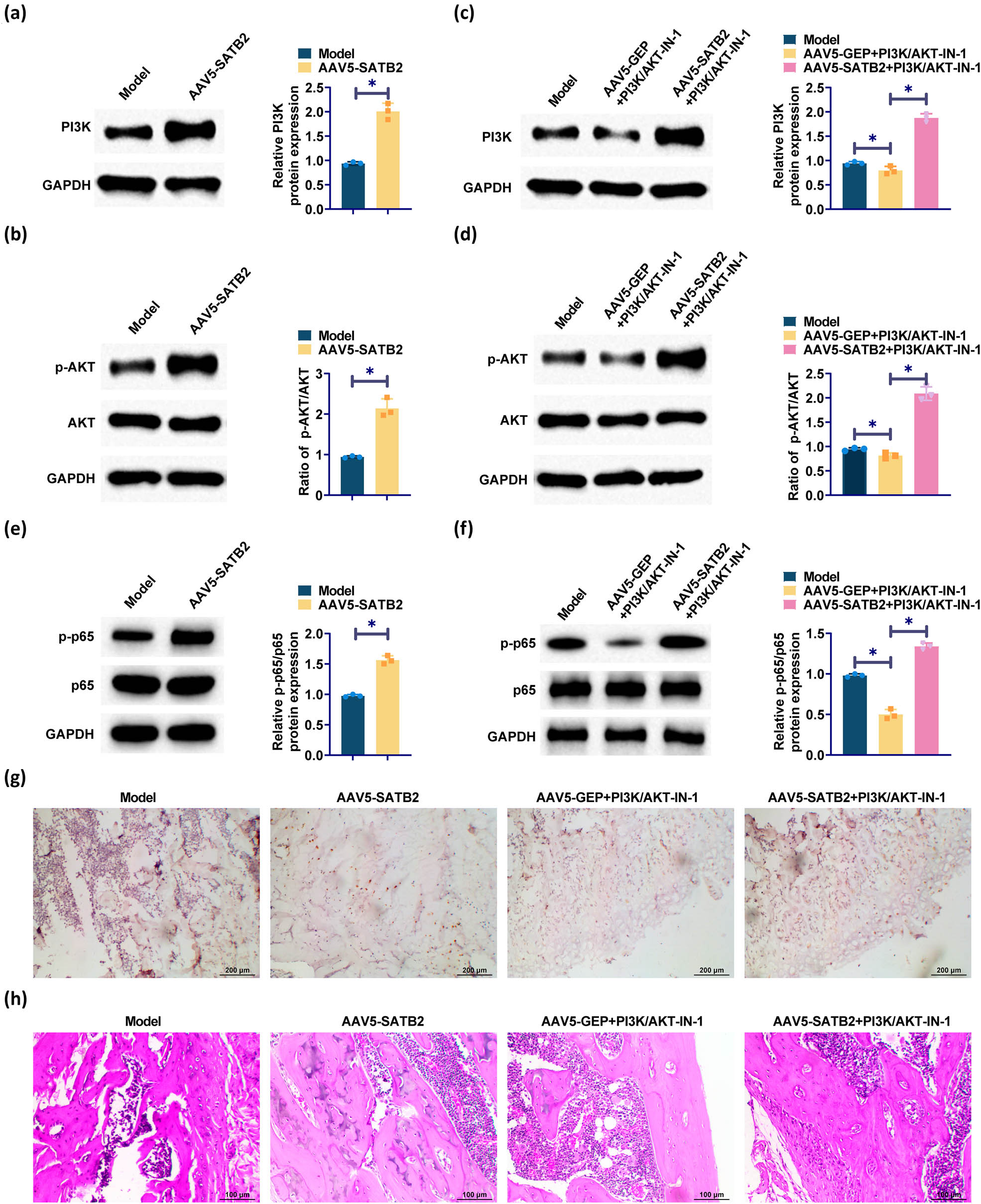 Figure 5 
                  Expression of PI3K/AKT pathway-related proteins in humerus tissues of rats. (a) and (c) Western blotting detected PI3K expression. (b) and (d) Western blotting detected p-AKT expression. (e) and (f) Western bolt for p-65 and p-p65 expression. (g) Immunohistochemical staining to detect the expression of PI3K and AKT in the fracture region of rats in each group. (h) HE staining showed histological findings of bone healing. *p < 0.05 was considered statistically significant.