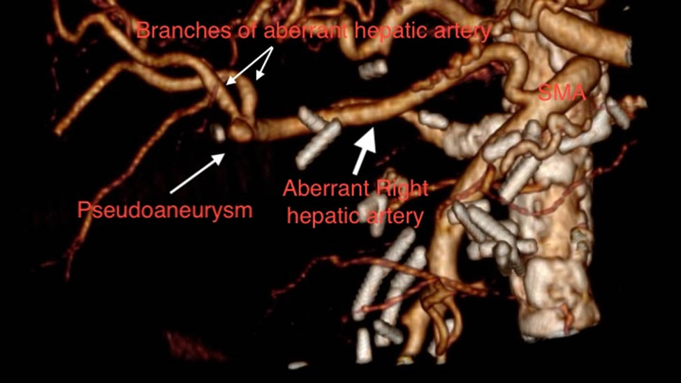 Figure 1
Anatomy explanation from the 3D reconstructed image.