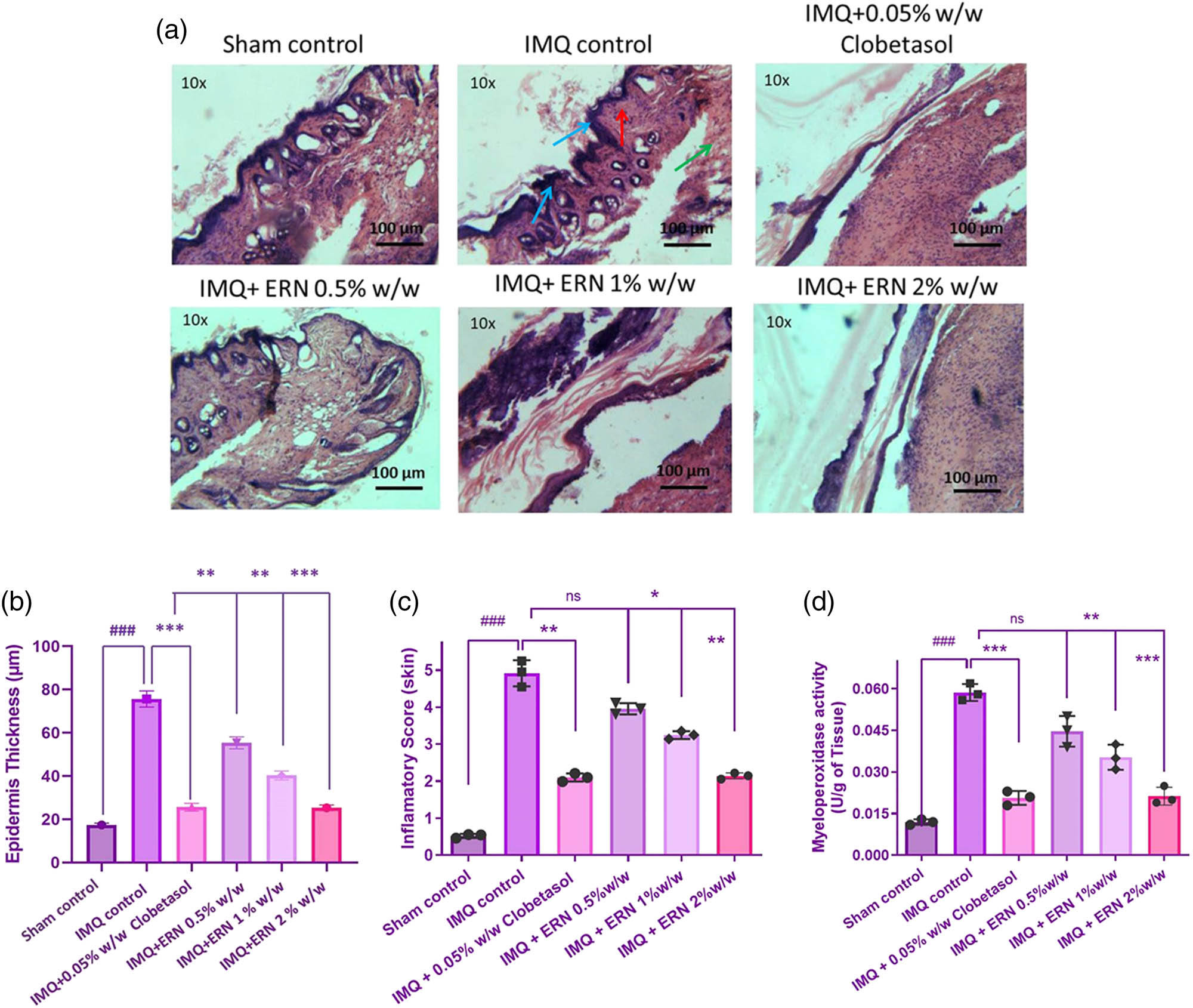 Figure 5 
                  Impact of ERN treatment on histopathological alterations in IMQ tempted psoriasis. Representative H&E-stained photomicrographs of (a) skin tissue for all experimental groups. Histopathological assessments include blue arrows indicating hyperkeratosis, red arrows denoting acanthosis, and green arrows highlighting the infiltration of neutrophils. (b) Quantification of epidermal thickness from H&E-stained dorsal skin sections. Epidermal thickness was measured at five randomly selected sites per section using ImageJ software. IMQ-induced epidermal thickening was significantly reduced following ERN treatment in a dose-dependent manner. (c) Inflammatory score of the skin and (d) MPO activity in skin tissue. Blue arrows indicate hyperkeratosis, red arrows indicate acanthosis, and green arrows indicate infiltration of neutrophils in histopathology images. Data are expressed as mean values ± SD. n = 6 animals per group, experiments were repeated three times. ###
                     p < 0.001; ##
                     p < 0.01, #
                     p < 0.05 compared with the sham control group; *p < 0.05, **p < 0.01, and ***p < 0.001 compared with the IMQ alone treated group; ns, non-significant.
               