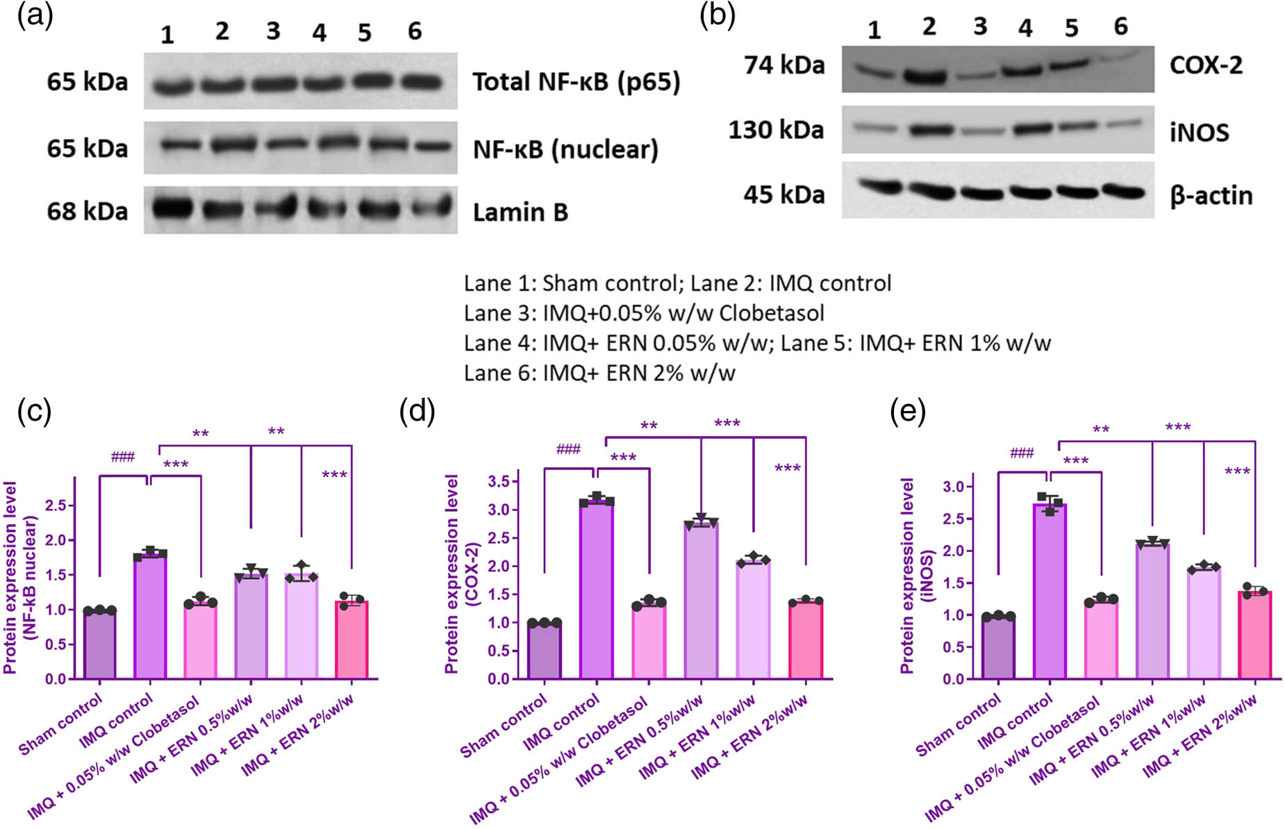 Figure 8 
                  Impact of ERN therapy on the NF-κB signaling pathway in skin tissue produced by IMQ. The appearance levels of p65, COX-2, and iNOS in the skin tissue of IMQ compared to ERN are shown in (a) and (b), an illustrative immunological blot analysis. β-actin and Lamin B served as the internal reference. (c)–(e) shows the band intensities measured concerning protein expression using Image J software analyses. The findings were expressed using the mean value ± SEM (n = 3). ###
                     p < 0.001 compared with the sham control group; **p < 0.01 and ***p < 0.001 compared with the IMQ alone treated group.
               