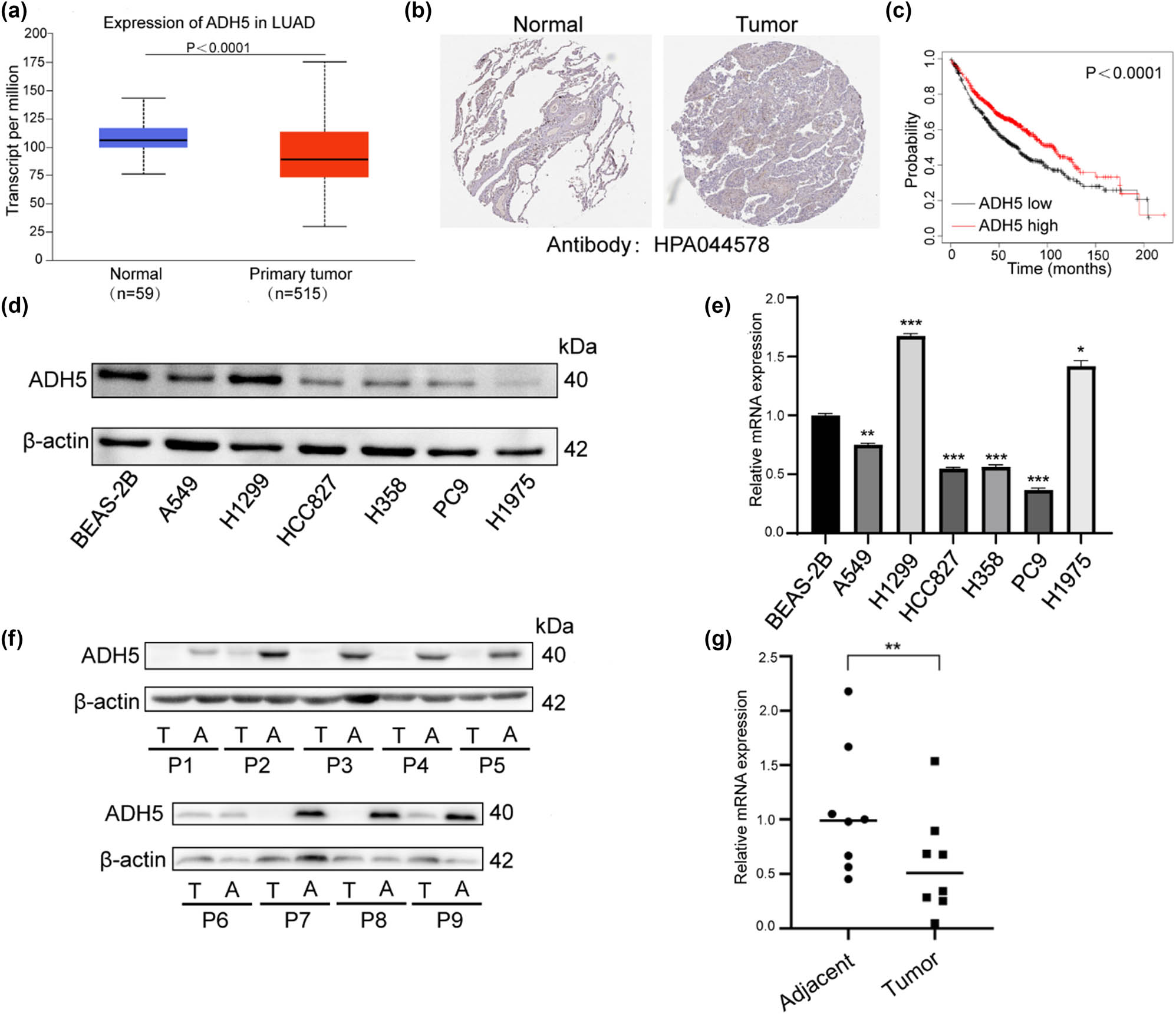 Figure 1 
                  Expression of ADH5 in NSCLC cell lines and tissues. (a) mRNA expression of ADH5 from TCGA database. (b) ADH5 protein expression in normal tissues and lung adenocarcinoma from THPA. (c) Kaplan–Meier analysis indicated that the low expression of ADH5 was significantly correlated with poor overall survival. (d) Western blotting analysis of ADH5 expression in NSCLC cell lines and one normal human bronchial epithelial cell line. (e) Relative mRNA expression of ADH5 in lung cancer cell lines. ADH5 expression was examined using qRT-PCR and was normalized to GAPDH expression. (f) Western blotting analysis of ADH5 expression in NSCLC tissues compared with corresponding adjacent tissues. (g) Relative expression levels of ADH5 in NSCLC tissues compared with corresponding adjacent tissues. Data from cells were generated from at least three biologically independent experiments. *P < 0.05, **P < 0.01, ***P < 0.001.
               