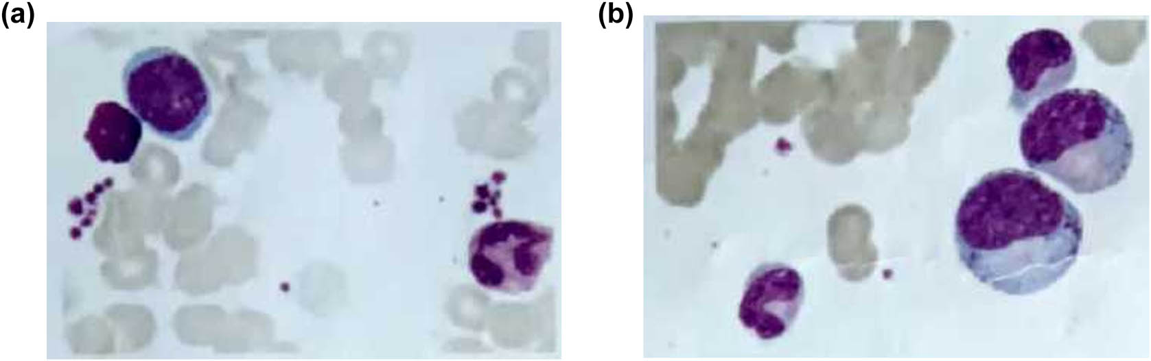 Teaser image from the article