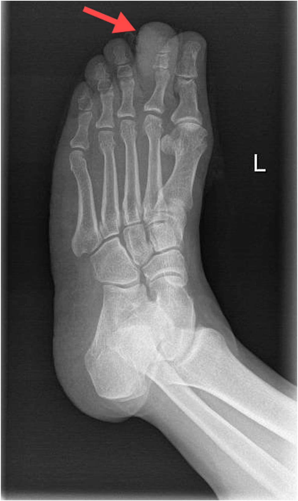 Teaser image from the article