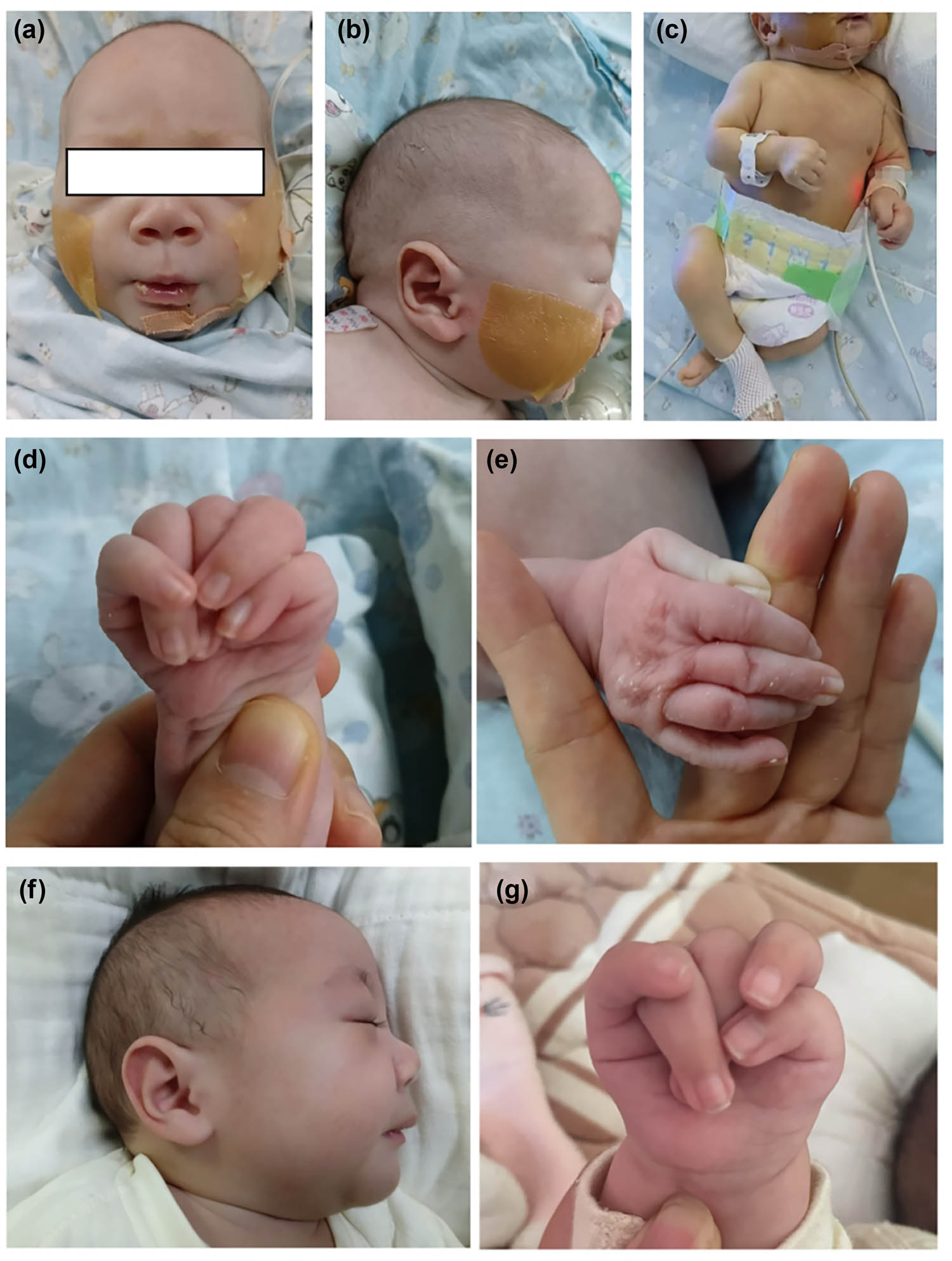 Teaser image from the article