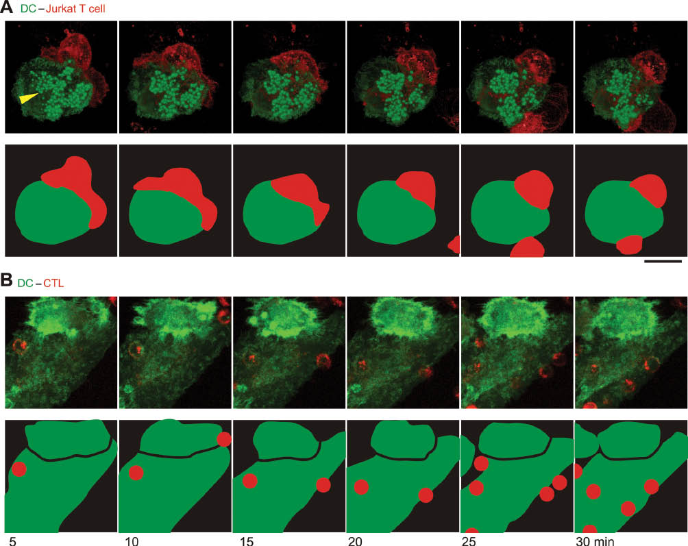 Figure 1: Structural differences in DC immunological synapses with Jurkat or primary T cells.(A) An antigen specific synapse between a Jurkat T cell (red) and a DC differentiated from peripheral blood mononuclear cells (green). Jurkat T cells were heterologously expressing a TCR recognizing a tumor antigenic peptide (gp100 residues 280–288) (64). DCs were expressing the actin binding protein LifeAct fused to GFP (green), as described (108), and were loaded with an excess of antigenic gp100 peptide. The Jurkat T cells were labeled with a far-red fluorescent membrane marker (red). The bright F-actin rich structures in the DC are podosomes (marked with a yellow arrowhead for t=5 min) (108). The upper row shows z-projections of confocal stacks recorded at the indicated time points after T cell addition. The lower row shows the schematic outline of the cells. Note that the Jurkat T cell first spreads out covering a large area of the DC surface and this is followed by cellular contraction. (B) Same as panel A, but now with primary CD8+ T cells transfected with the same TCR recognizing tumor antigen from gp100 (64). Primary T cells are much smaller (~5–10 μm diameter) than Jurkat T cells (20–50 μm diameter). Note that with primary T cells, the DCs (but not the T cells) show large structural deformations and cover large areas of the surface of the T cells. Scale bar: 20 μm.