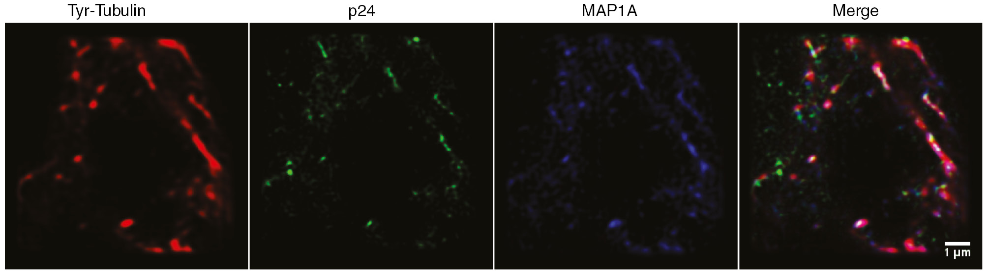 Figure 3: MAP1A interacts with HIV-1 capsid.Super resolution images of HIV-1 infected HeLa cells were acquired by BioAxial’s Conical Diffraction Microscopy (CODIM) (111) at 4 h post-infection. Cells were labeled with anti-tyrosinated (Tyr)-tubulin (red),anti-capsid p24 (green) andanti-MAP1A (blue) antibodies. Scale bar represents 1 µm.