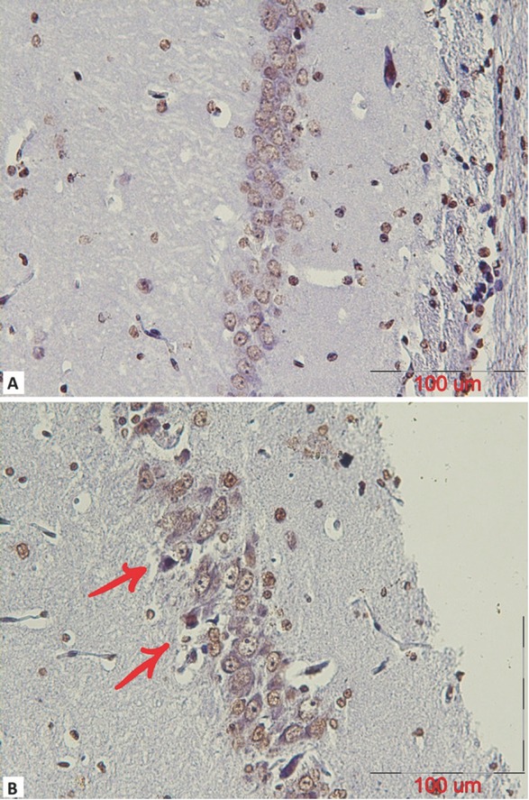 Figure 2 A representative coronal section of the CA1 part of a mature male rat’s hippocampus which was stained using a TUNEL assay to observe apoptotic cells in (A) control and (B) stanozolol treated groups. The arrows indicate TUNEL positive cells with dark brown nuclei (scalebar=100μm).