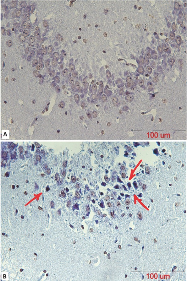Figure 3 A representative coronal section of the CA2 part of a mature male rat’s hippocampus stained using a TUNEL assay to observe apoptotic cells in (A) control and (B) stanozolol treated groups. The arrows indicate TUNEL positive cells with dark brown nuclei (scalebar=100μm).