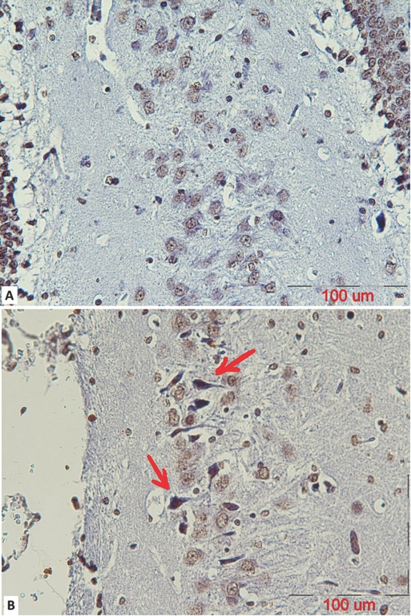 Figure 4 A representative coronal section of the CA3 part of a mature male rat’s hippocampus stained using a TUNEL assay to observe apoptotic cells in (A) control and (B) stanozolol treated groups. The arrows indicate TUNEL positive cells with dark brown nuclei (scalebar=100μm).