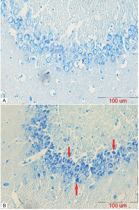 Figure 8 A representative coronal section of the CA2 area of a mature male rat’s hippocampus stained using Toluidine Blue to observe pre-apoptotic cells in (A) control and (B) stanozolol treated groups. The arrows indicate dark neurons (scalebar=100μm).