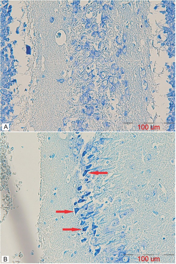 Figure 9 A representative coronal section of the CA3 area of a mature male rat’s hippocampus stained using Toluidine Blue to observe pre-apoptotic cells in (A) control and (B) stanozolol treated groups. The arrows indicate dark neurons (scalebar=100μm).